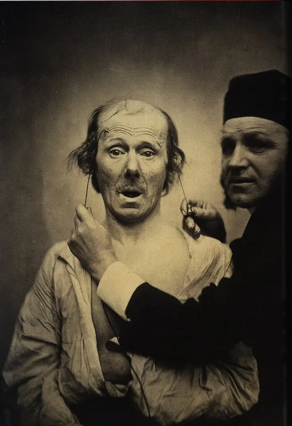 Grimaces savantes : autour de Duchenne de Boulogne